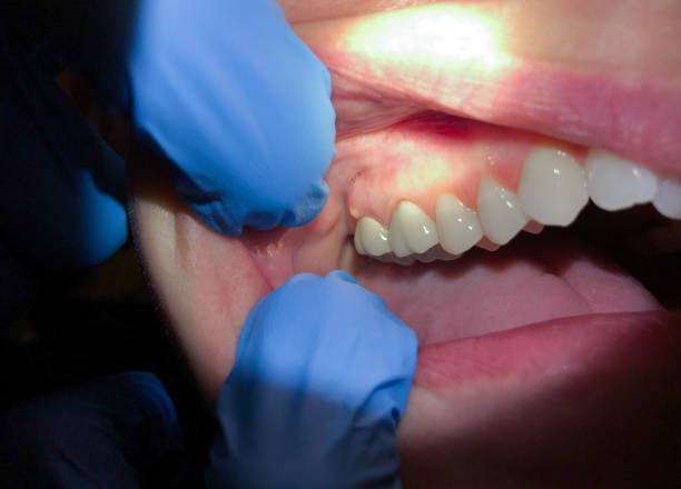Best Emergency Dentist for Special Needs Patients in Mount Carmel, TN