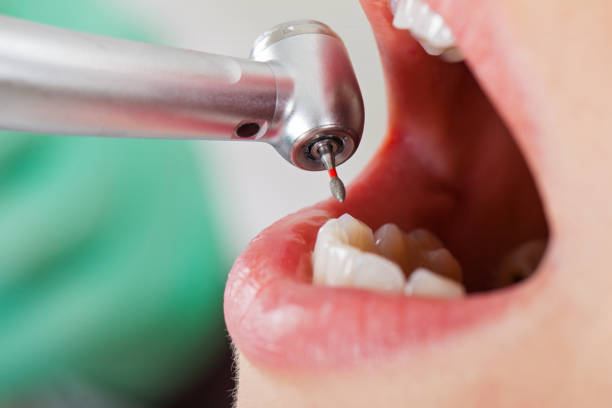 Best Urgent Dental Care for Toothache in Mount Carmel, TN